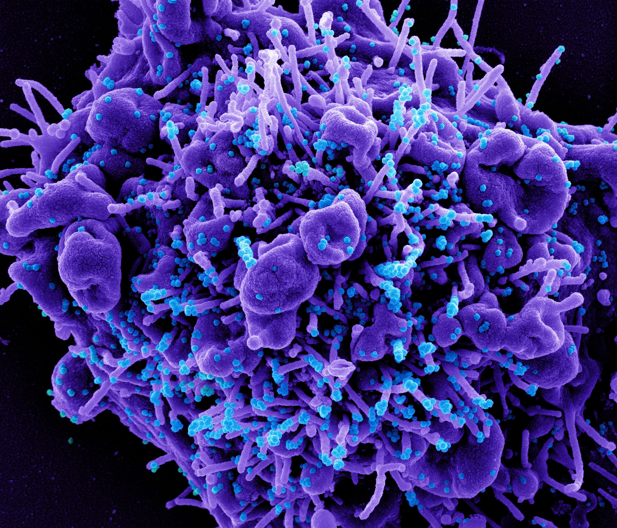 Image of the novel coronavirus, SARS-CoV-2