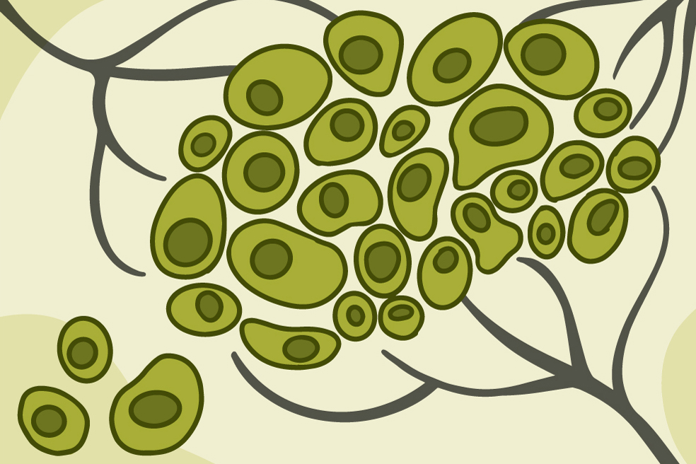 Illustration of cells migrating out of a tumor.