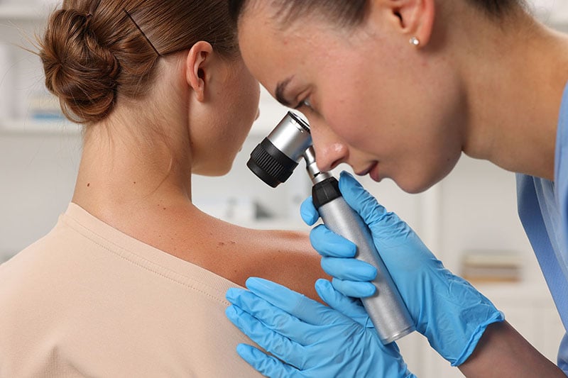 Health care provider looking at moles on the shoulder of a female patient using a dermatoscope.