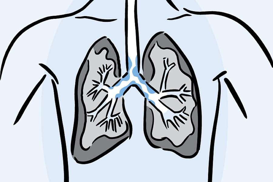 Illustration of lungs with mucus.