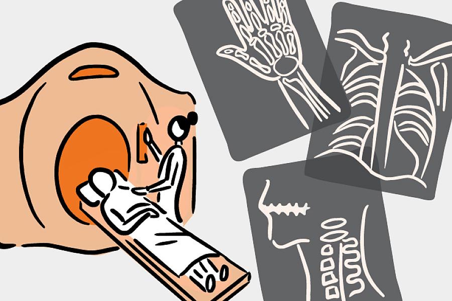 Illustration of 3 X-ray images and a patient entering a CT scanner.