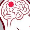 Illustration of a brain tumor. Illustration of a brain tumor.