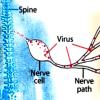 Illustration of the shingles pathway in the body Illustration of the shingles pathway in the body