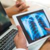 Health care provider looking at a lung X-ray in their office with a patient Health care provider looking at a lung X-ray in their office with a patient
