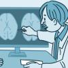 Illustration of a doctor showing a patient an MRI of the brain.