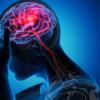 Illustration of a person holding their head with the brain showing inside.
