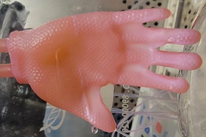 A bioengineered glove of human skin created for grafting.